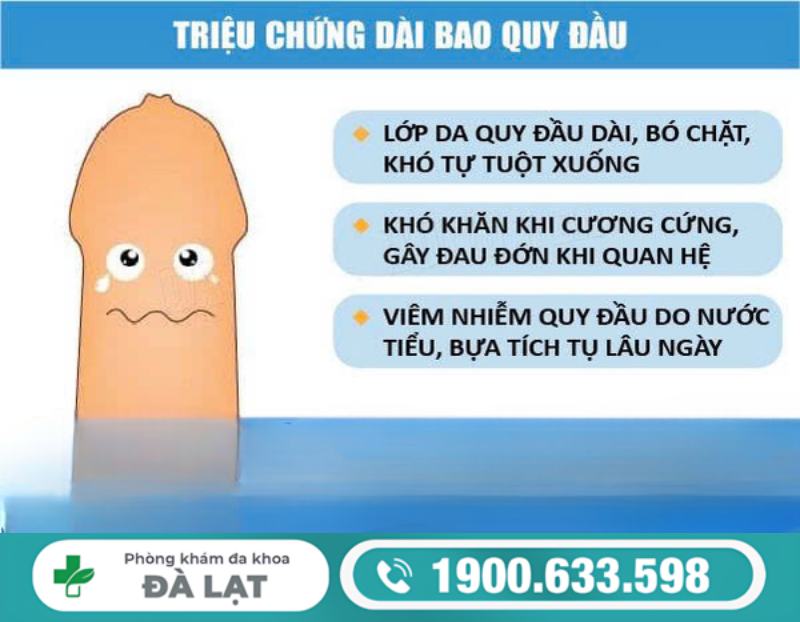 Hình ảnh minh họa